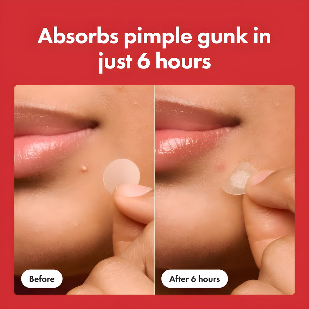 HERO Mighty Pimple Patch